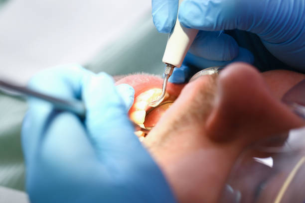 Best Emergency Dental Care for Broken or Chipped Teeth in Hazlehurst, GA